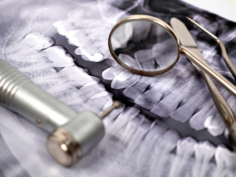 ddc-endodontologie